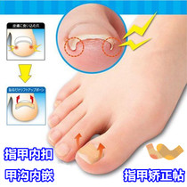 Japanese Lala patch Nail long meat nail patch Nail groove embedded buckle inflammation roll nail corrector Toenail patch correction