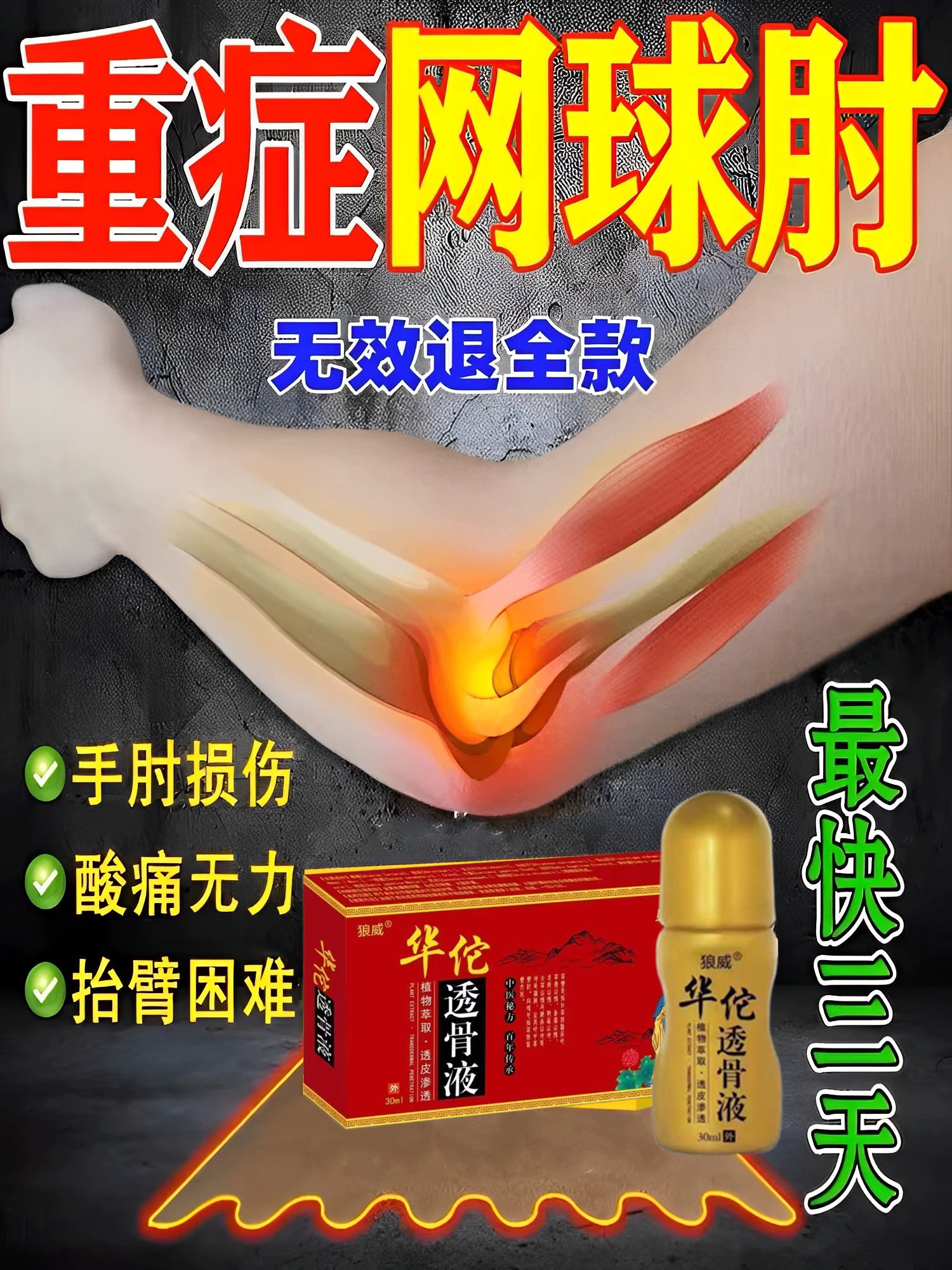 Netball Elbows Star Special Medicine Elbow External joint pain Acid linen tennis Elbow Special Potentate to Twist Bone Fluid-Taobao