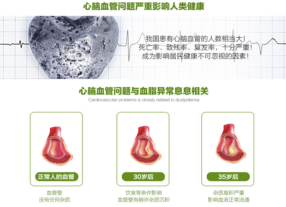 Swisse đậu nành lecithin viên nang mềm 150 viên nang ống chăm sóc sức khỏe hàng năm của Úc 2 lần từ - Thức ăn bổ sung dinh dưỡng viên canxi