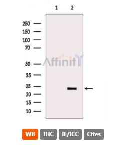 Affinity 兔多克隆一抗 IL-6 (人 大鼠 小鼠）应用WB IF IHC 50ul