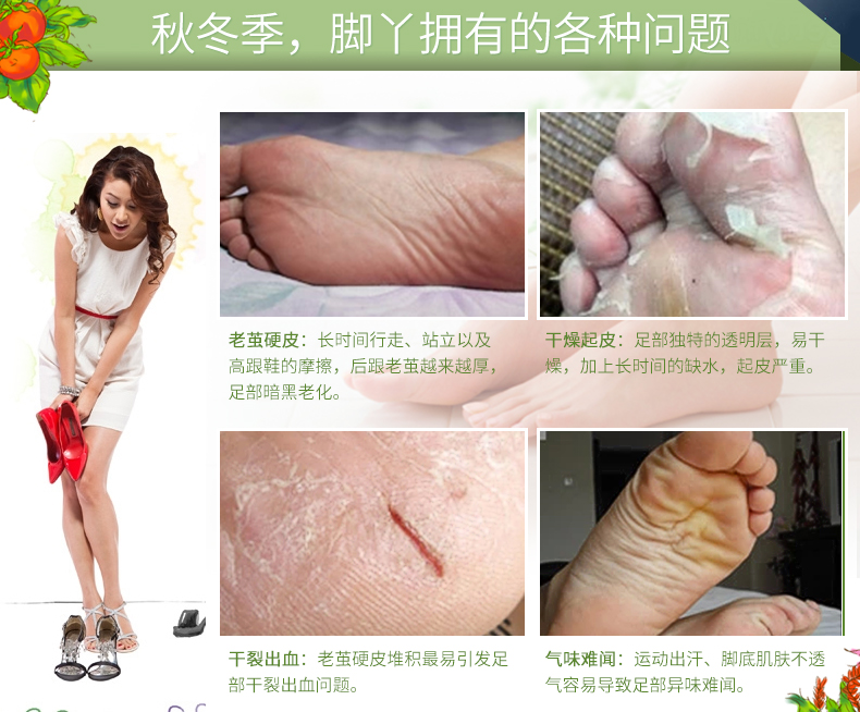 Bánh cà chua kem dưỡng ẩm 3 gậy chân làm trắng giữ ẩm dưỡng ẩm tẩy tế bào chết chăm sóc bàn chân chống khô mặt nạ lột da chân