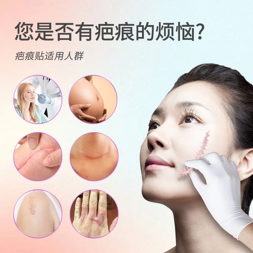 Силиконовый пластырь Mepicare для восстановления шрамов, шведский оригинальный импортный кесарево сечение, официальный флагманский магазин, крем для удаления шрамов