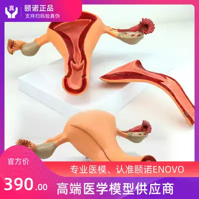 ENOVO Medical female internal reproductive organ model Uterus ovary reproductive structure Obstetrics and gynecology model