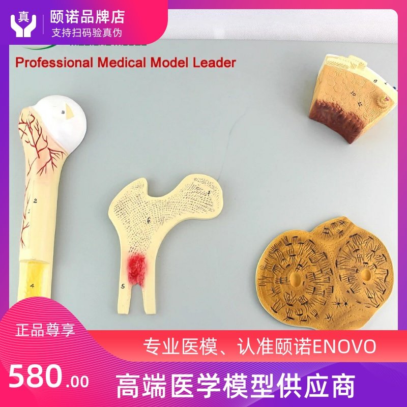 ENOVO Hino bone structure model vascular pine bone dense bone and femur Haver system human bones