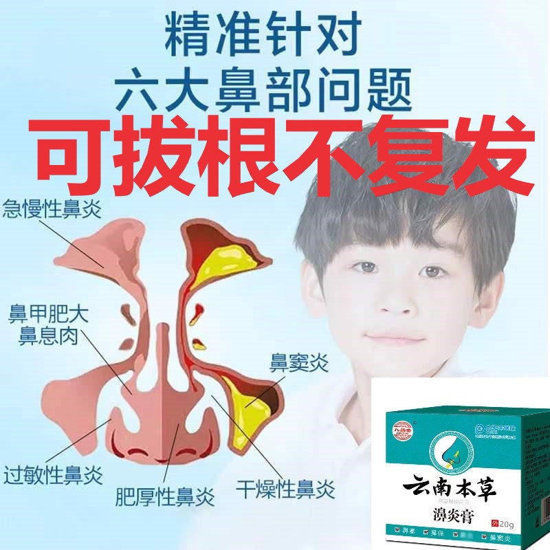 Miaojia rhinitis ointment sinusitis special allergic rhinitis cure goose does not eat grass rhinitis ointment spray