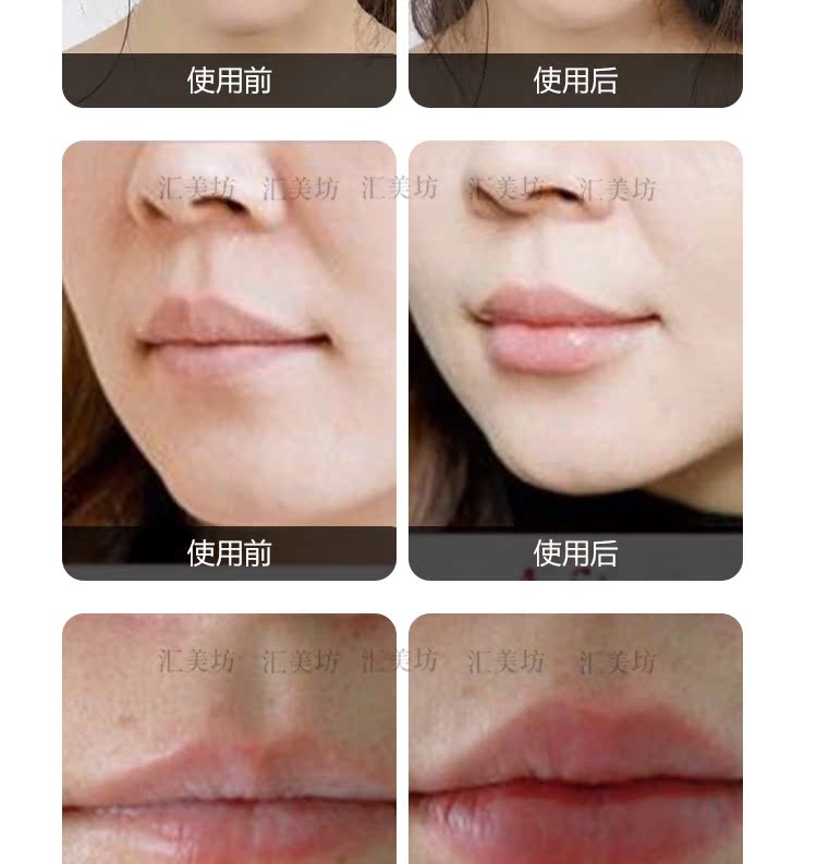 Huimeifang chăm sóc da tinh chất dầu môi môi đầy đủ massage môi mỏng dày vi khắc Fengdu môi - Tinh dầu điều trị tinh dầu xông phòng thơm