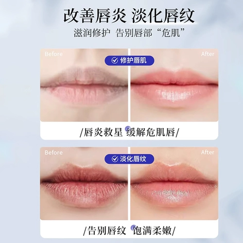 Shiseido, японская витаминизированная помада, увлажняющий бальзам для губ, маска для губ