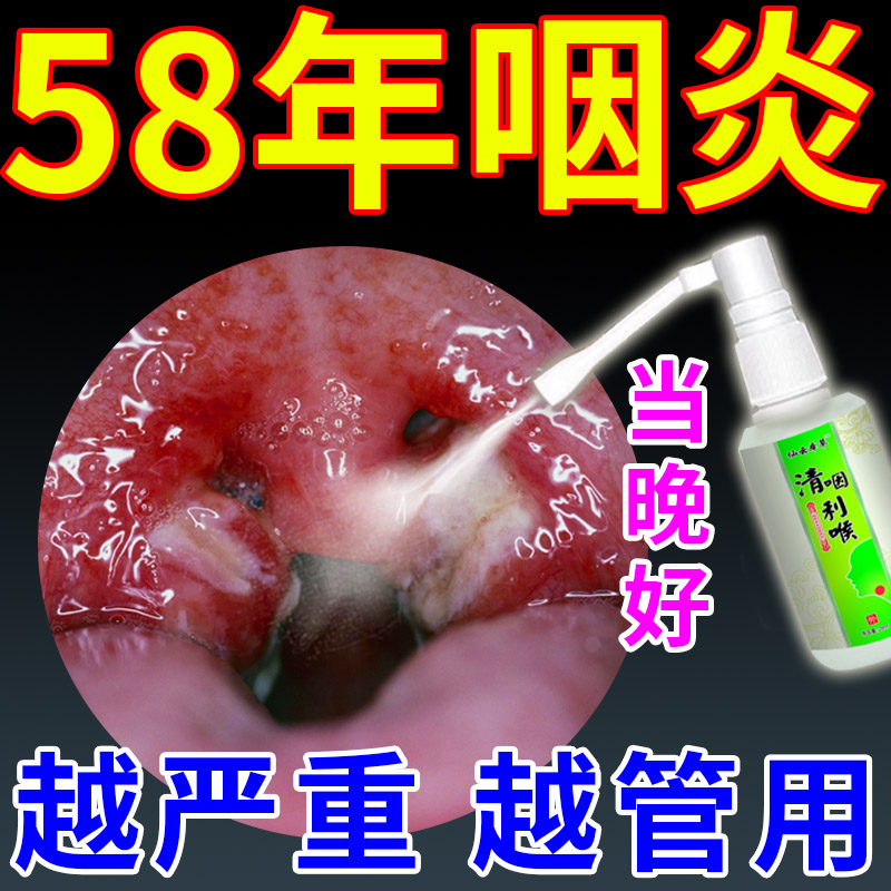 Specialized in pharyngitis chronic pharyngitis remove root throat pain and phlegm foreign body sensor drying and itching special medicine