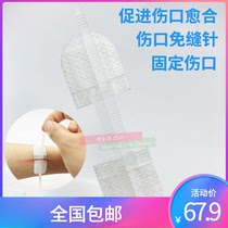 Wound suture patch wound reduction bandage small wound suture tie no suture patch 1 piece