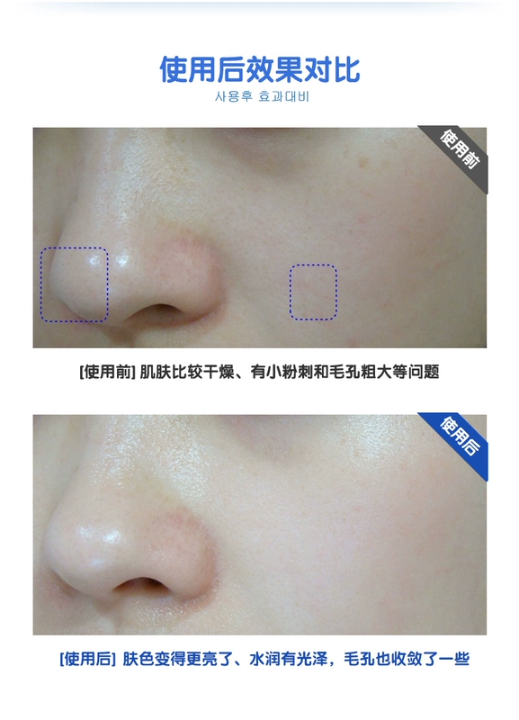 MEDIHEAL Meidi Huierke Lai Si tổ yến sào axit amin mặt nạ 10 miếng dưỡng ẩm làm săn chắc da cho nam và nữ - Mặt nạ