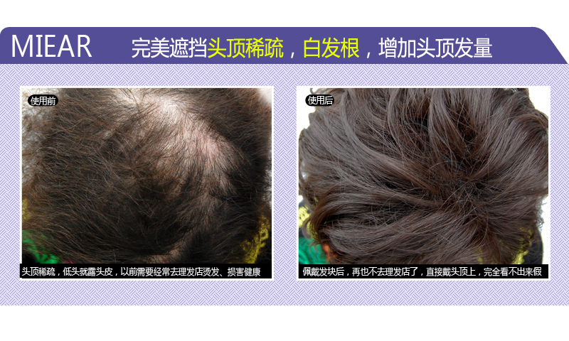 Extension mèches - Ref 225275 Image 26