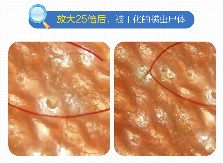 bình xịt muỗi xịn Spot Nhật Bản nhập khẩu mạt dán hộ gia đình ngoài bọ ve diệt ve chống mạt mat không phun - Thuốc diệt côn trùng bình xịt muỗi hiệu quả