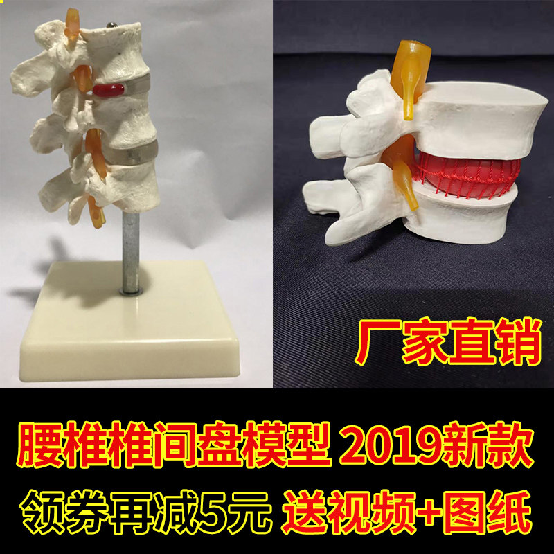 人体腰椎间盘模型 专业演示脊椎关节模型 腰椎模型脊柱 正品包邮!