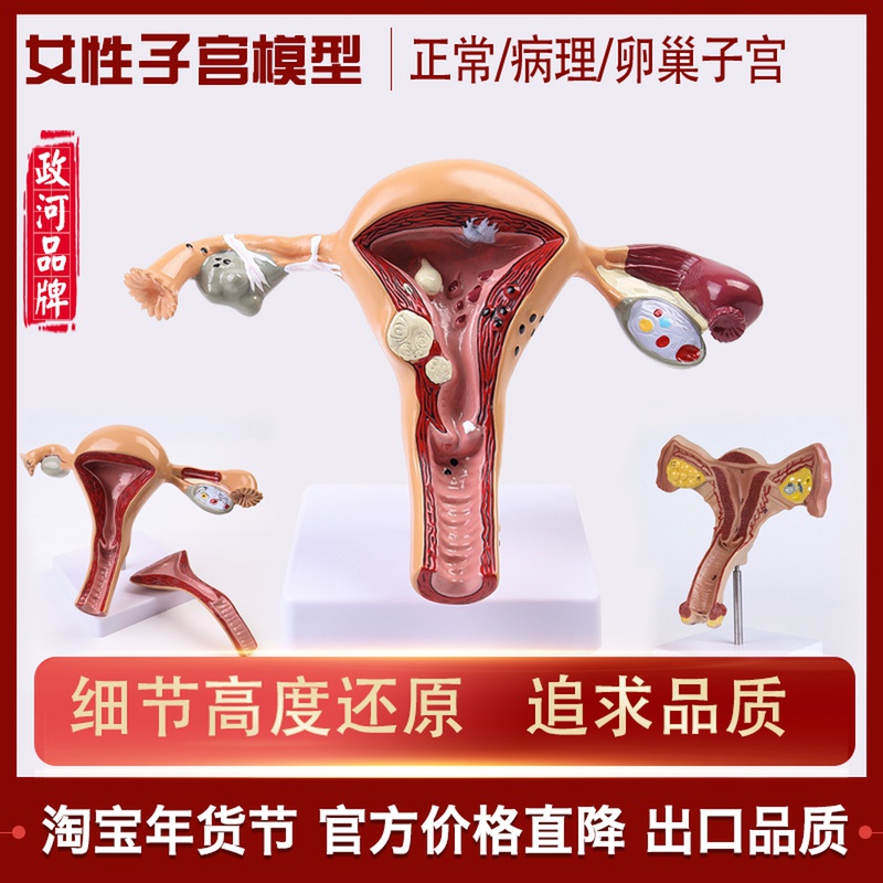 Human body model female reproductive pathology uterine vagina ovary medical teaching mold pathological changes training equipment