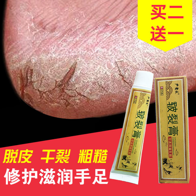 Hands and feet cracked dry and dry peeling feet heel cracked break repairing protective cream seasonal anti-column paste heel
