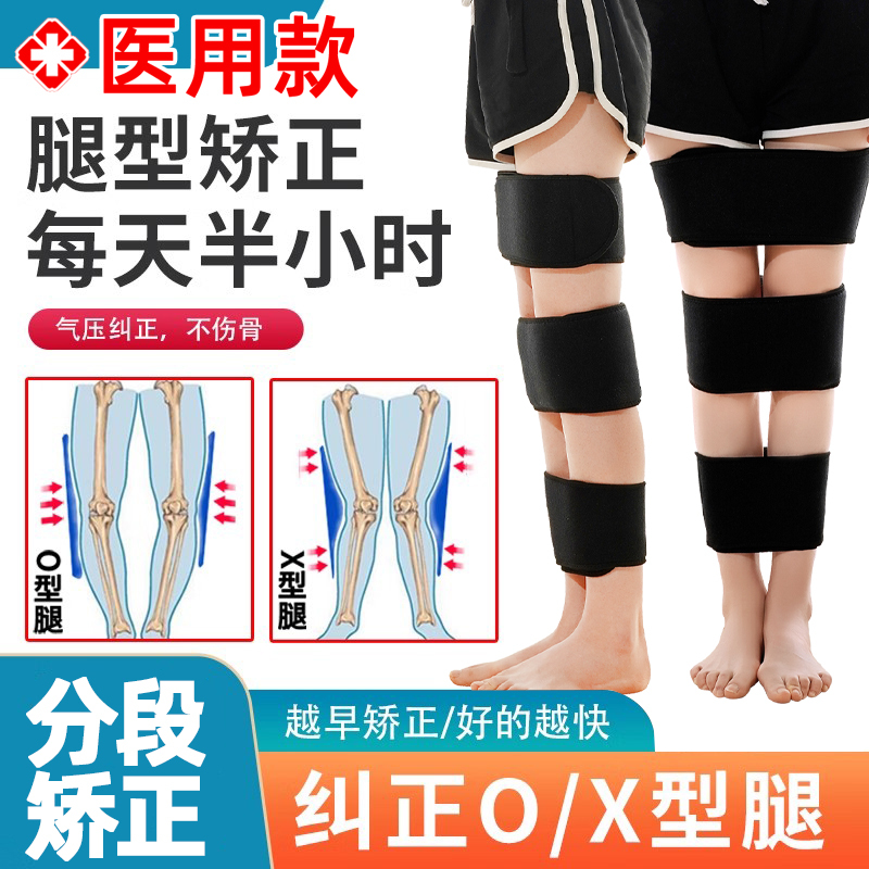 O-Shaped Legs, X-Shaped Legs, Xo-Shaped Legs Correction Belt, Bow-Legged Leg Brace, Straight Leg Correction, Inward and Outward Splayed Calf Correction Device
