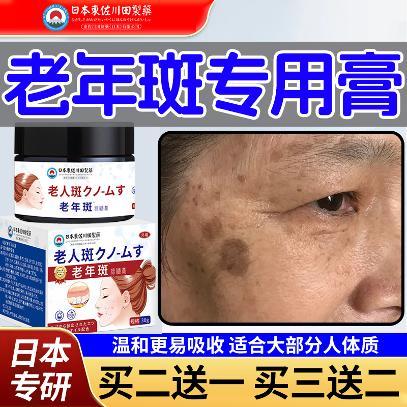 Japanese Anti-Aging Spot Removal Cream, Powerful Spot Removal Cream for Face, Hands, and Arms, Specifically for Elderly People with Dark Spots and Yellow Spots
