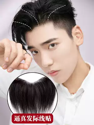 Hairline wig sticker Invisible Men's forehead replacement film full real hair male head top replacement block M-type fake bangs