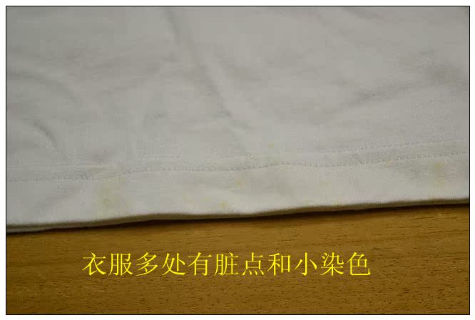 Áo Ada nguyên bản của đội nam Pháp chống cổ áo cotton thể thao và giải trí Áo sơ mi POLO cỡ lớn TAD19038 - Áo polo thể thao áo thun polo