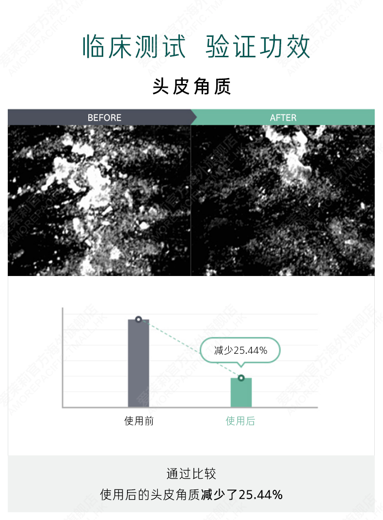 韩国进口 爱茉莉 02绿茶防脱洗发水 500g*2瓶 持久清爽 图5