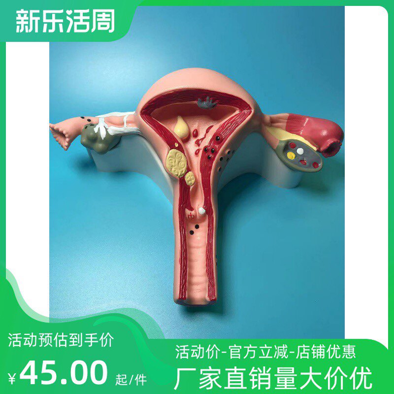 人体子宫模型教具模具阴道卵巢解剖病理医学女性仿真女性生殖模器
