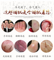 Kangjide frostbite cream Special quick freezing will cure safflower snake oil hands feet ears cracking itching swelling frostbite cream