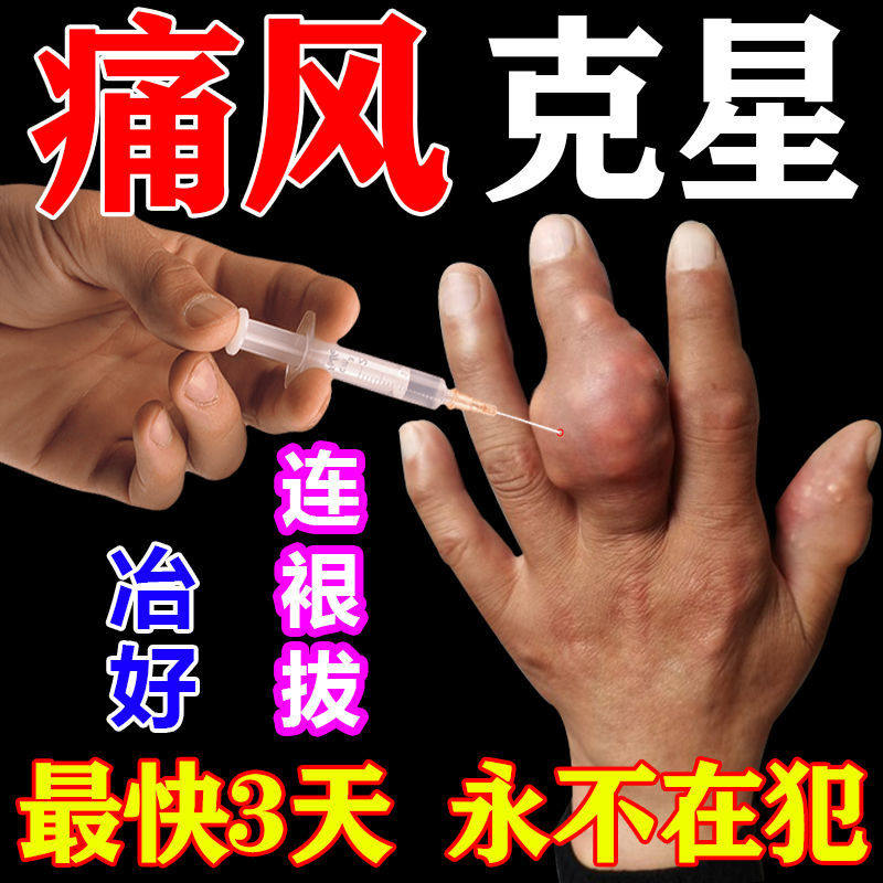 Gout Special medicine gout Gout Spray of Uric Acid Rheumatic Arthritis Swollen Pain Relief Patch New plasters GS