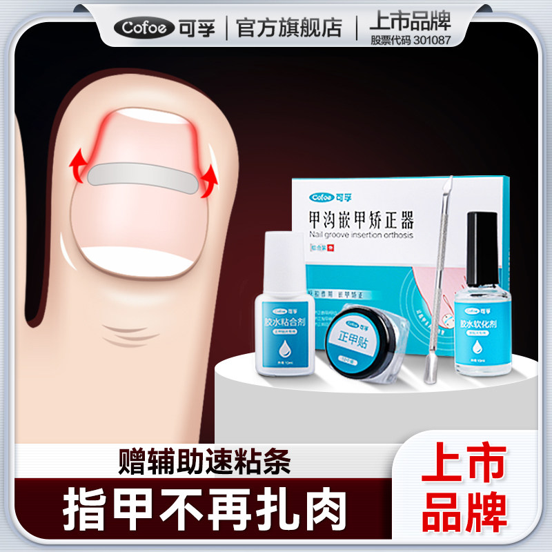 嵌甲甲沟炎矫正器正甲贴片脚趾甲修护专用 甲片修正神器成人适用