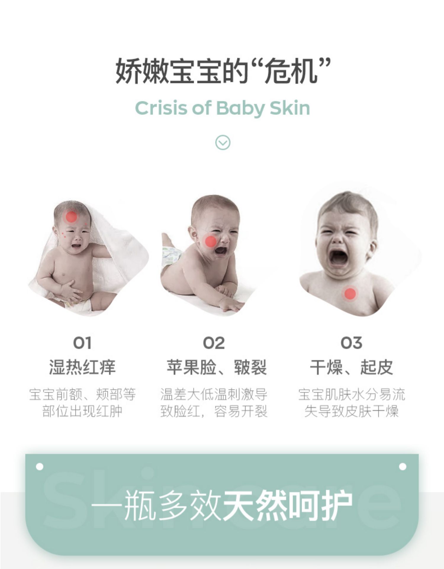 Songda baby camellia Oil cream children wet ngứa baby rash cream Nước bọt kem dưỡng ẩm cơ thể sản phẩm chăm sóc da tự nhiên - Sản phẩm chăm sóc em bé tắm sữa tắm bubchen