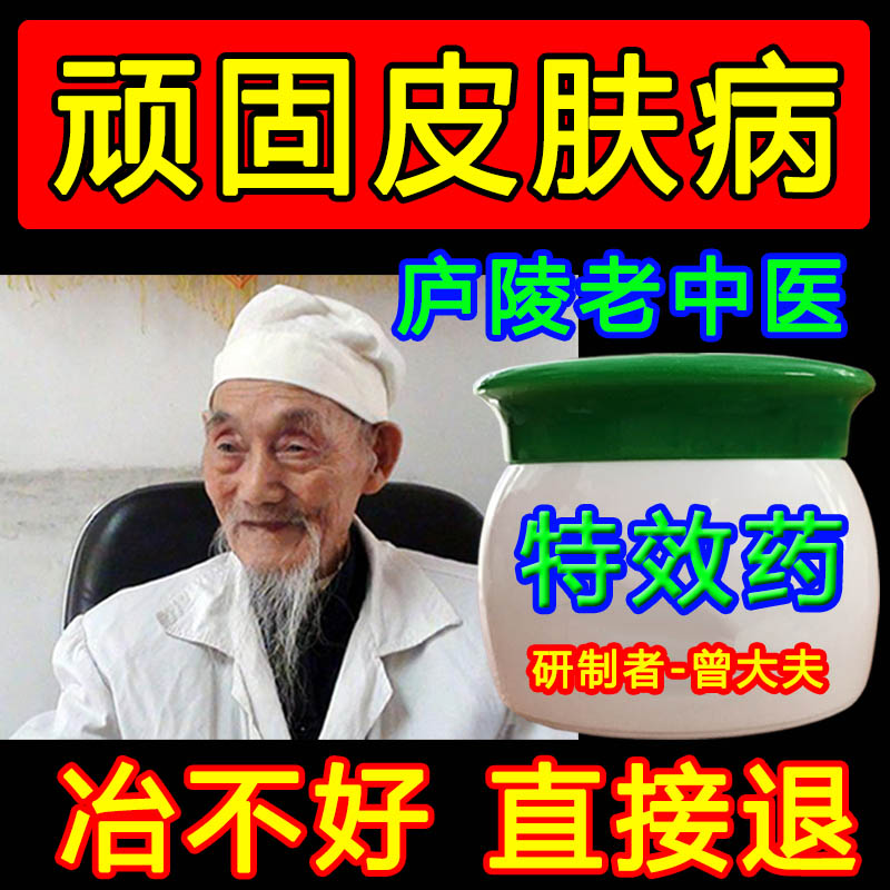 Psoriasis Psoriasis External medicine Ointment No Hormone Old Metaphine Cream Head Scalp Fresh Plasters Silver Thalassaemia Special