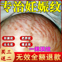 Stretch mark removal ointment repair cream obesity mark reduction cream stretch mark removal cream stretch mark removal cream stretch mark removal cream belly tightening cream