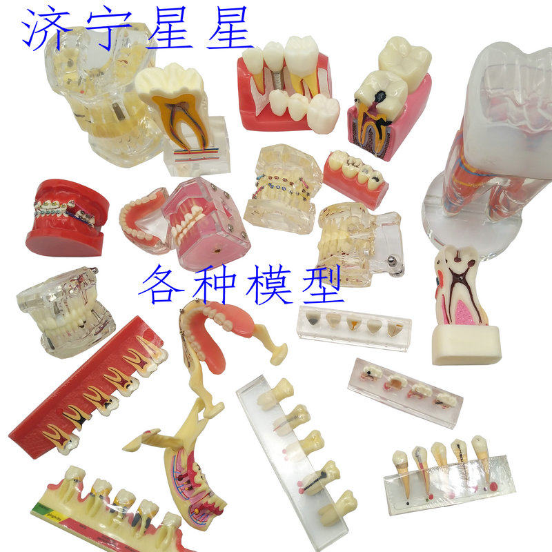 Jining star dental model oral root canal in vitro dentist communication pathological implant deciduous teeth corrective inlay