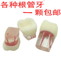 Exam exercises Use a Resin Dental Model of the root of the tooth in the open pulp of the pulp cavity with the root of the tooth.