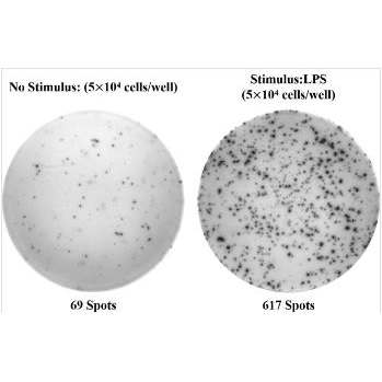 Human IL-10 (Interleukin 10) ELISPOT Kit  酶联免疫斑点检测