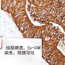 EP-CAM 迈新 MAB-0850 上皮细胞黏附因子