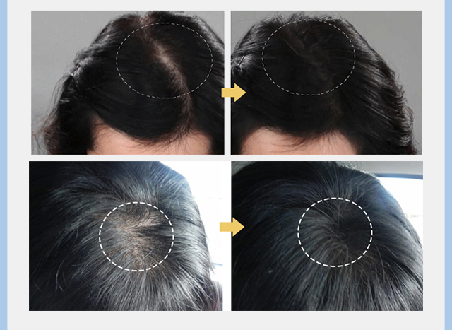 Chạy mô hình đàn ông Hàn Quốc Mamonde giấc mơ trang điểm sửa chữa năng lực bột phấn cao ánh sáng bóng điền vào tóc tạo tác tạo khối black rouge