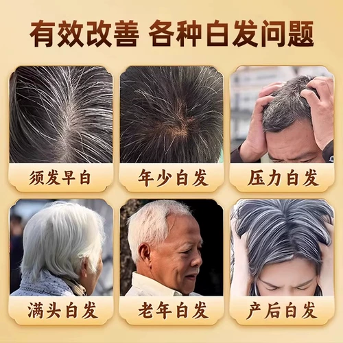 Бушен Янсиэ таблетки подлинное питательное ци и лечение крови для преждевременного отбеливания волос и дефицита ци и крови в слабости тела у почек и печени, питательной печени ФК