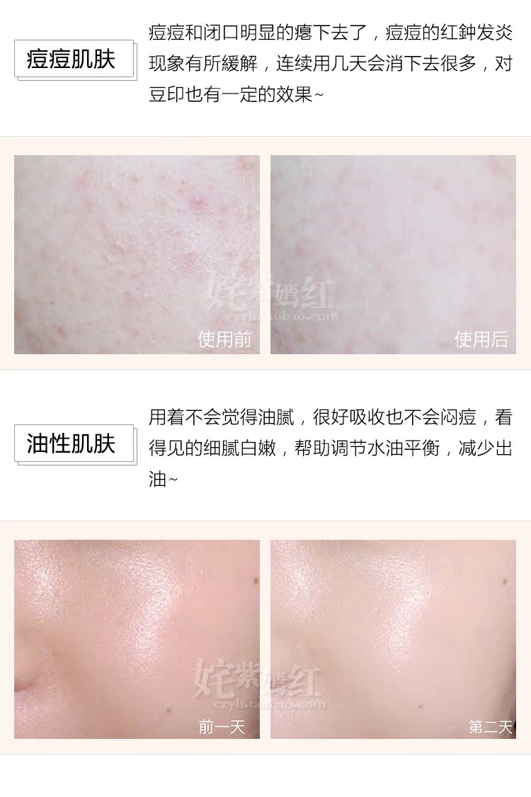 Sửa chữa và cải thiện các vấn đề về da! Hàn Quốc Dongguo Dược phẩm Centellian24 Centella Grass Mask 10 cái mặt nạ nén