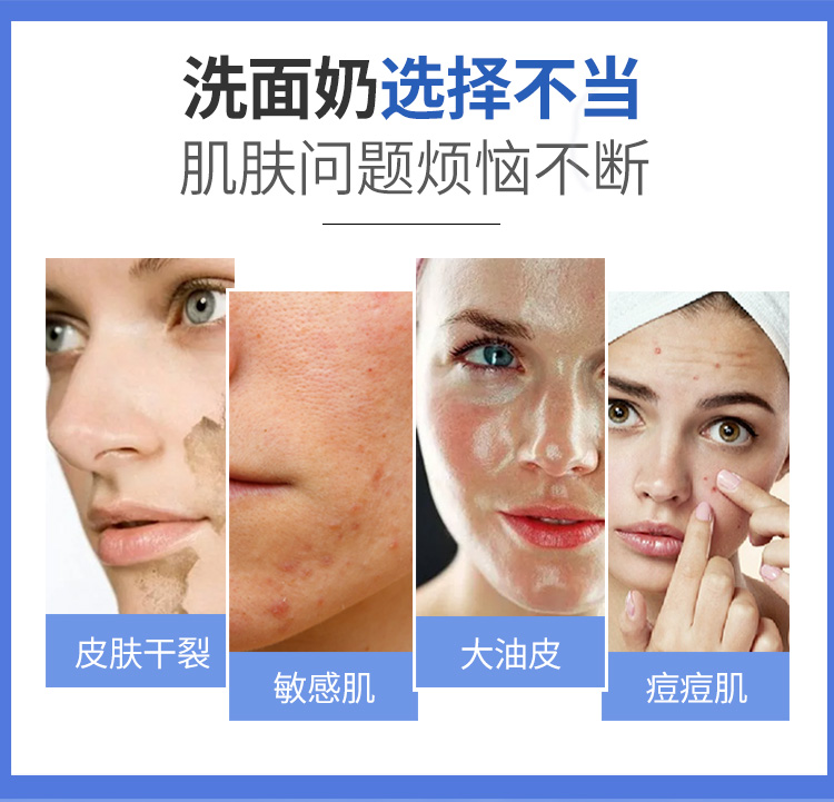 Sữa rửa mặt Yi Xue nam và nữ thu nhỏ lỗ chân lông dưỡng ẩm kiểm soát mụn làm sạch sâu bằng sữa rửa mặt srm acnes