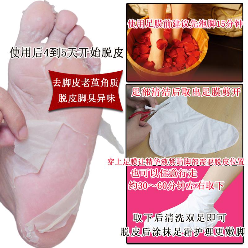 足膜脚皮护理老茧后跟脚丫脚后跟底角干裂去死角质足部护理死皮