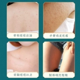 [Не отступайте Doudou], а задний Дуду сказал, что на спине нет бобов, и мужчины и женщины могут купить 2 получить 1 бесплатно