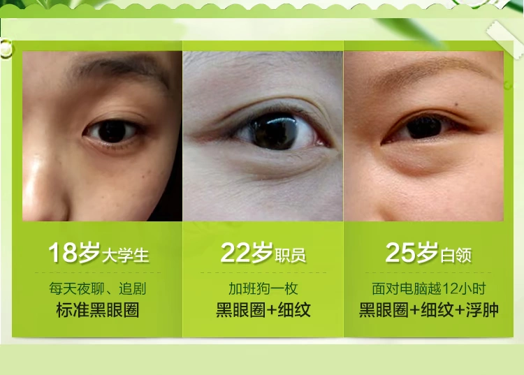 菲儿 青春 抗皱 30g để nếp nhăn làm săn chắc mắt chống nhăn