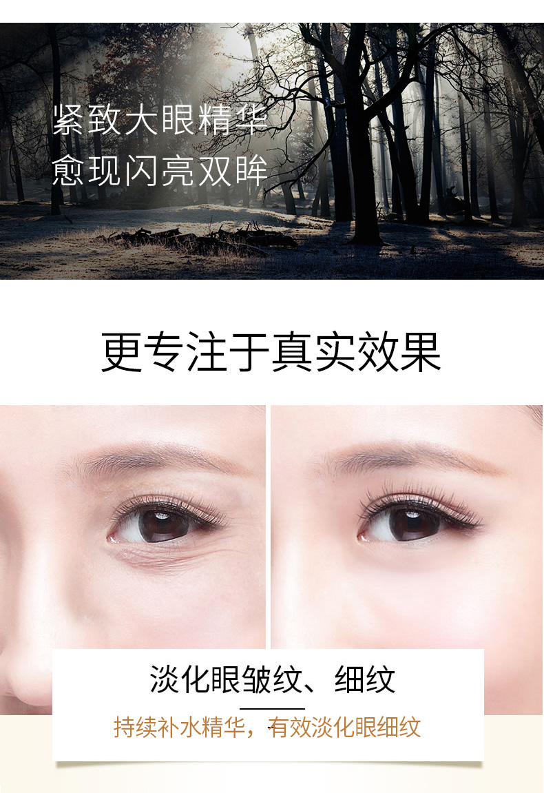 Lancome eye cream flagship store Ying Âm quầng thâm túi mắt nữ túi mắt mịn dòng dưỡng ẩm chăm sóc mắt kem trị nhăn mắt
