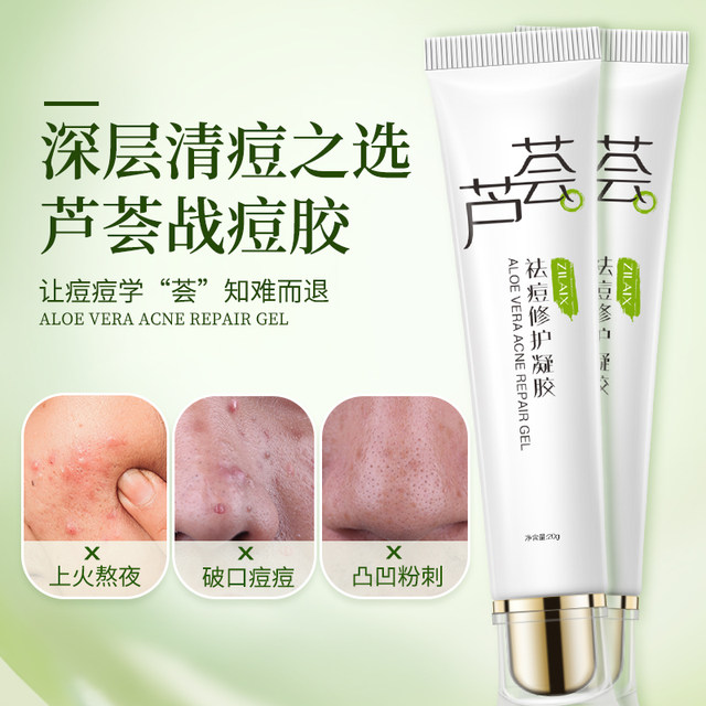 Aloe vera gel ກຳຈັດສິວ, ສ້ອມແຊມຮູຂຸມຂົນແລະລົດຮອຍສິວທີ່ເປັນທາງການ, ຄີມຕ້ານສິວ, ຂອງແທ້ ສຳ ລັບຜູ້ຍິງແລະຜູ້ຊາຍ.