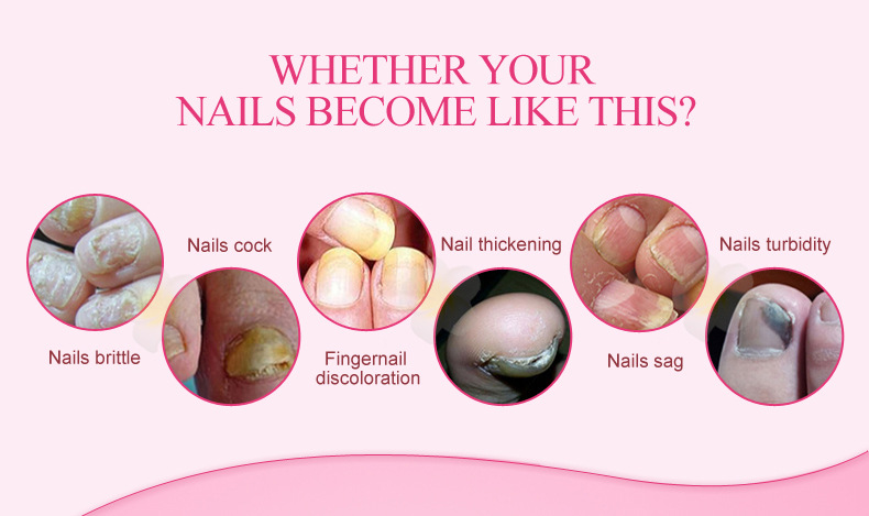 Title 3, Beauty Hand And Foot Nail Repair Cream