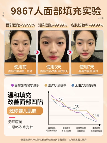 Снимите храм слезной канавы фэн, щеки, депрессия, заполняя глаз лоб глазного лоба, фиксируя полное