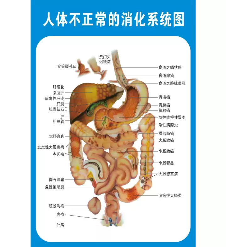 彩色人體內臟解剖圖牆貼裝飾醫療健康海報 血液循環系統示意圖