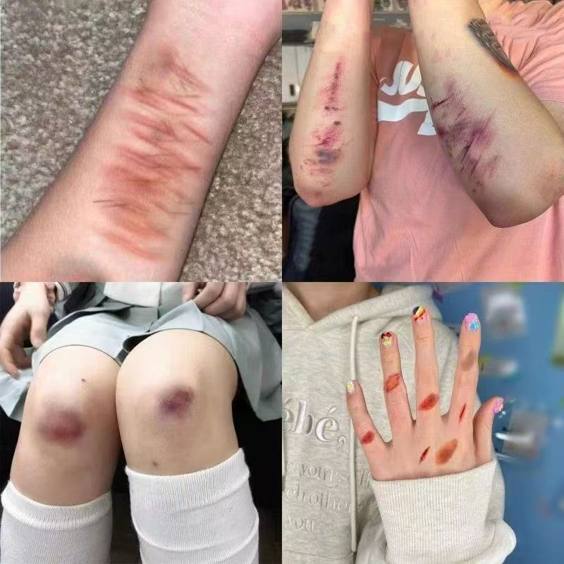 Scary Prank Makeup, Wrist Cuts, Bruises, Abrasions, Burns, Scratches, Plasma Scars, Fake Facial Tattoos Scary Prank Makeup, Wrist Cuts, Bruises, Abrasions, Burns, Scratches, Plasma Scars, Fake Facial Tattoos