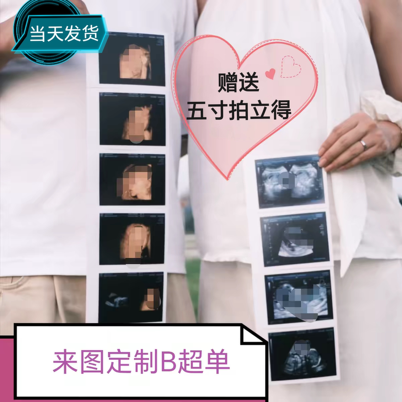 Xiaohongshu Recommends Pregnancy Announcement Photos, Large Ultrasound Scans, Single-Frame Puzzle Baby 3D Photos, and Pregnancy Photos to Share