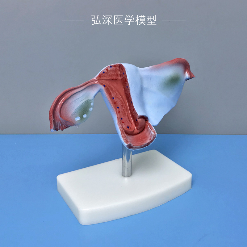 Female Uterus Model, Human Reproductive System Organ Anatomy, Ovaries, Fallopian Tubes, Obstetrics and Gynecology Medical Teaching Model